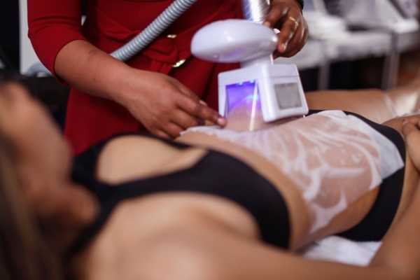 Get Your Dream Body with Non-Invasive Fat Freezing Bexley