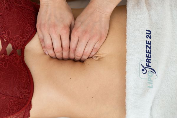 diastasis recti treatment Bexley