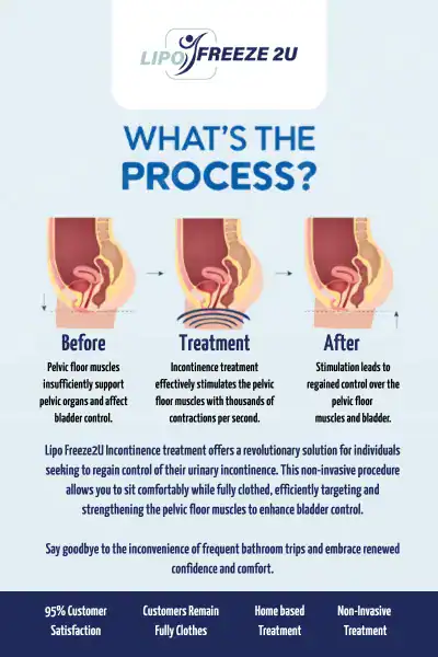 Diagram of how incontinence treatment Bexley works.