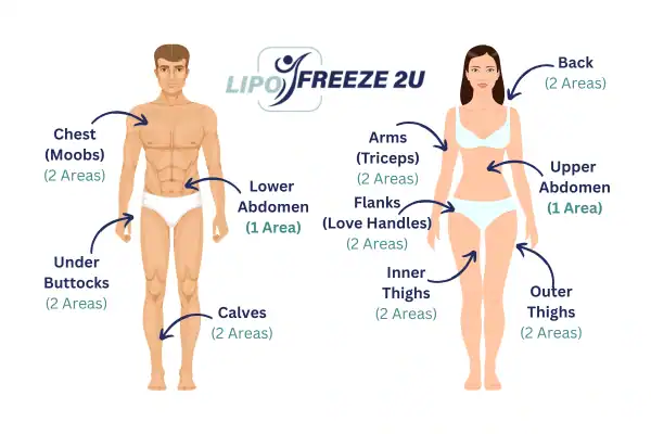 Areas you can have fat freezing treatment Bexley