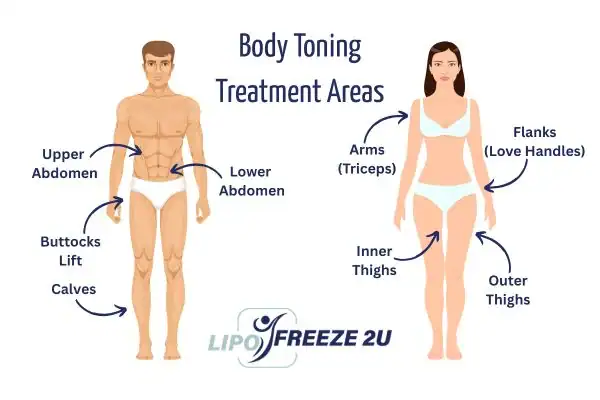 Graphic showing where you can have Body toning Treatment Bexley on your body