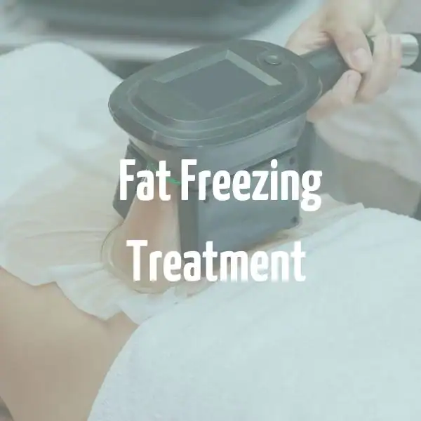 fat freezing treatment Bexley