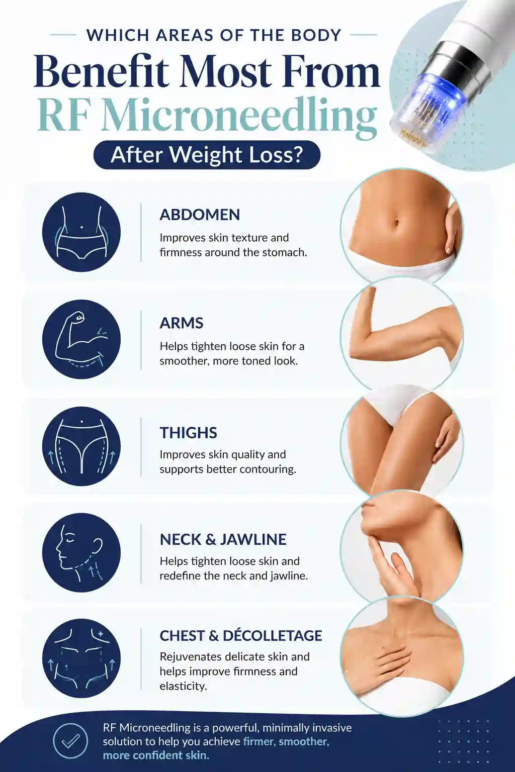 Which Areas of the Body Benefit Most From RF Microneedling After Weight Loss Bexley